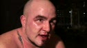 Jeremy Holmes beat up but victorious