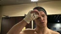 Robert Eno post fight
